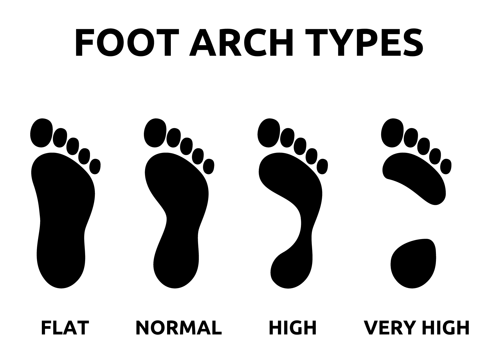 4 foot arch types: flat - normal - high - very high