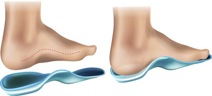 orthopedic insole orthotic arch support